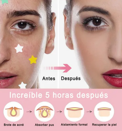 Parche Anti Granitos